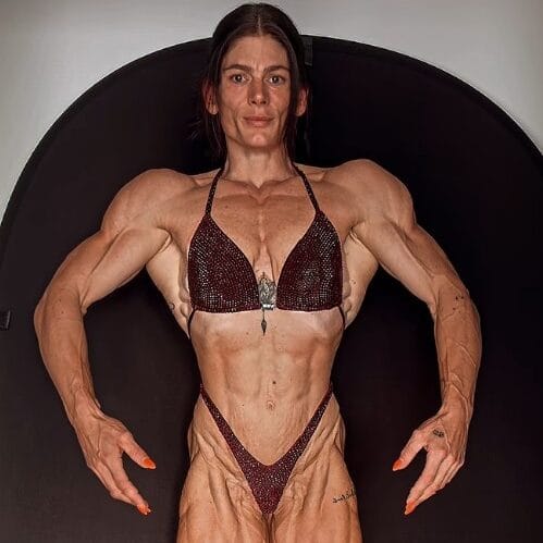 Anika Hinzer